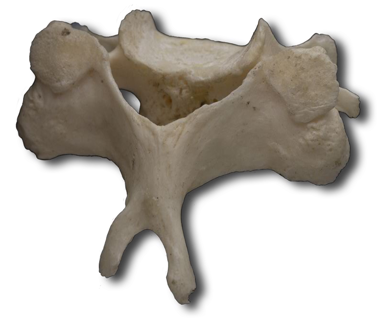 Anatomy Pathways - Vertebral Column