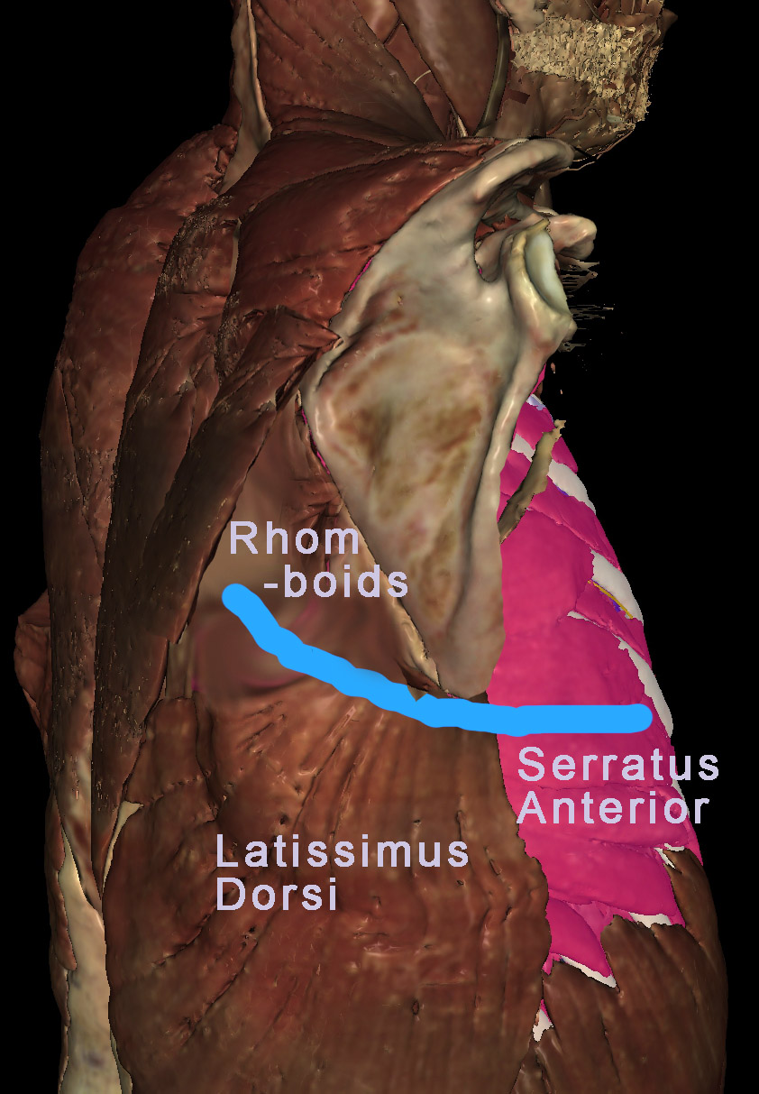 Incision for a Lateral Thoracotomy