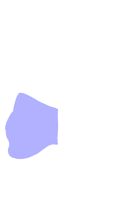 Lateral Condyle