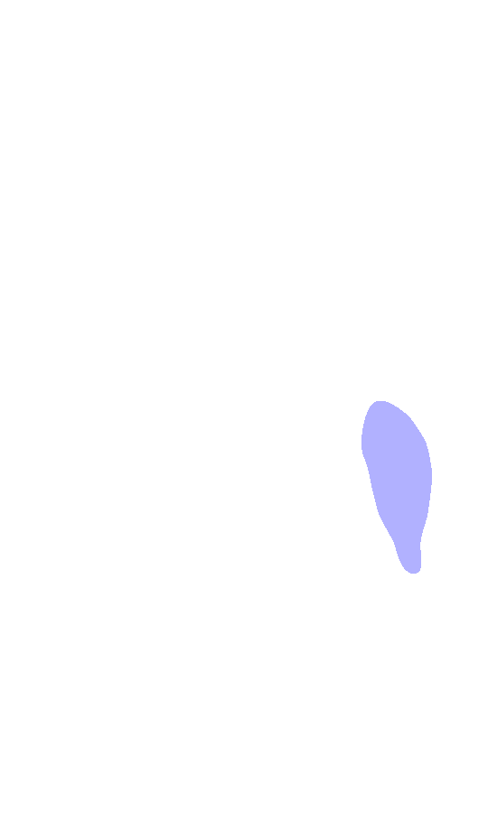Medial Epicondyle