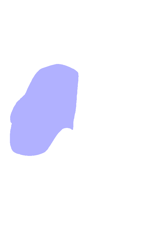 Lateral Condyle