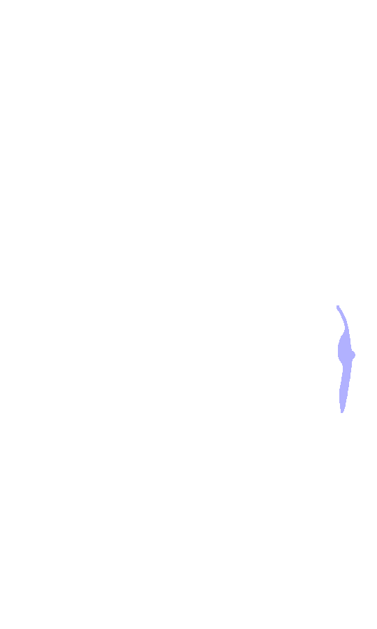 Medial Epicondyle