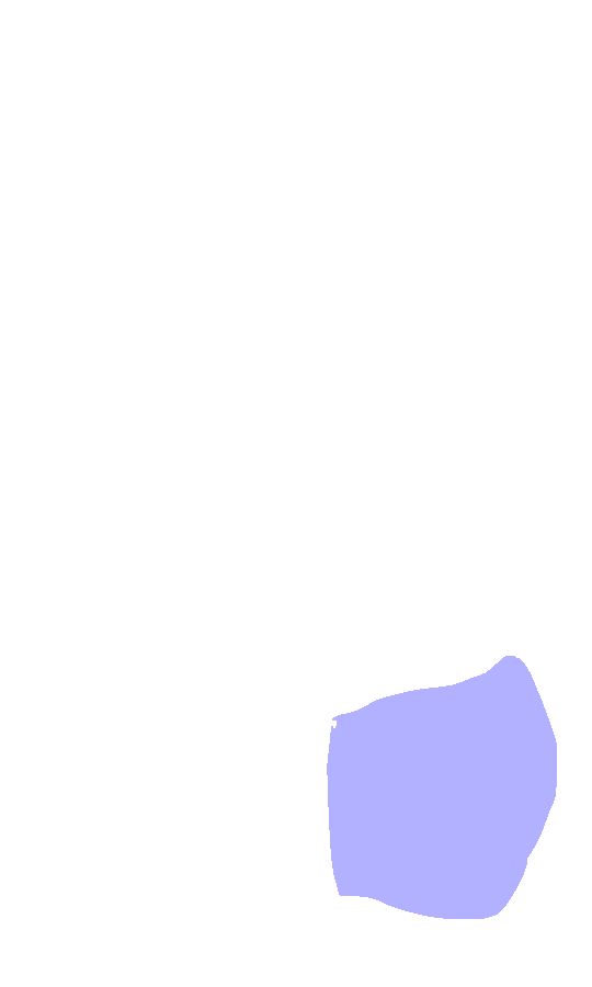 Medial Condyle