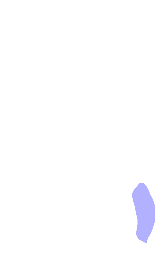 Medial Epicondyle