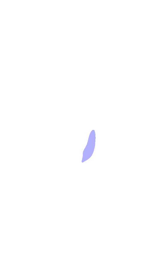 Lesser Trochanter