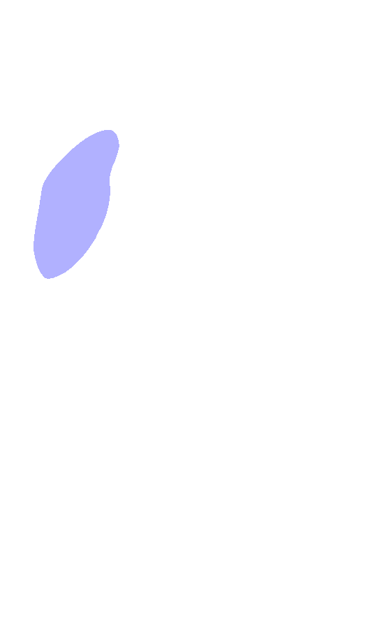 Greater Trochanter