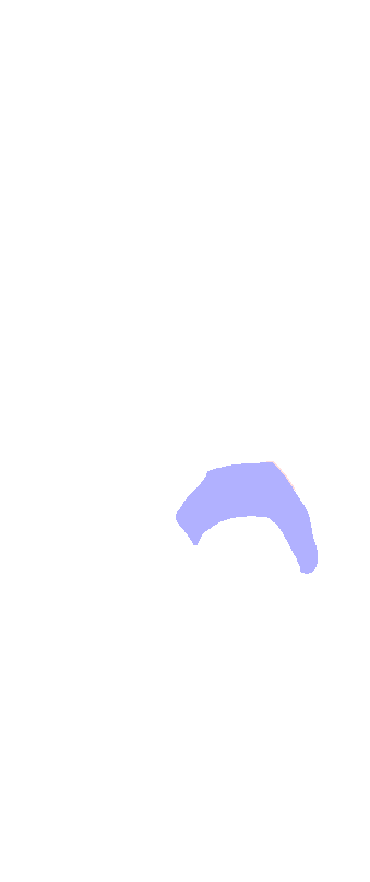 Navicular