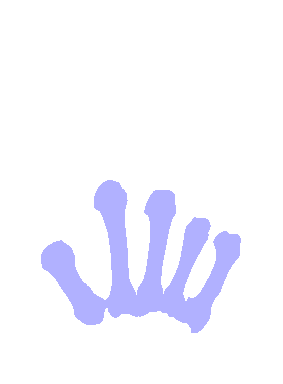 Metacarpals