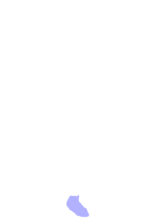 Scaphoid