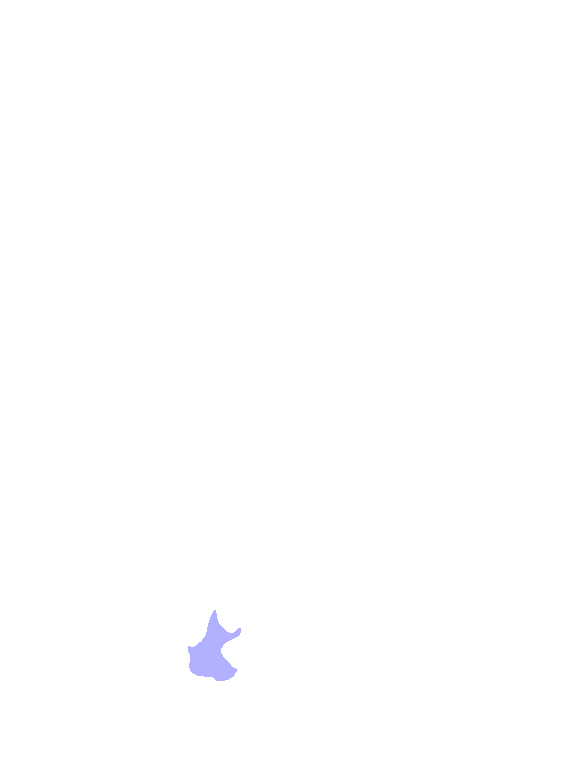 Trapezium
