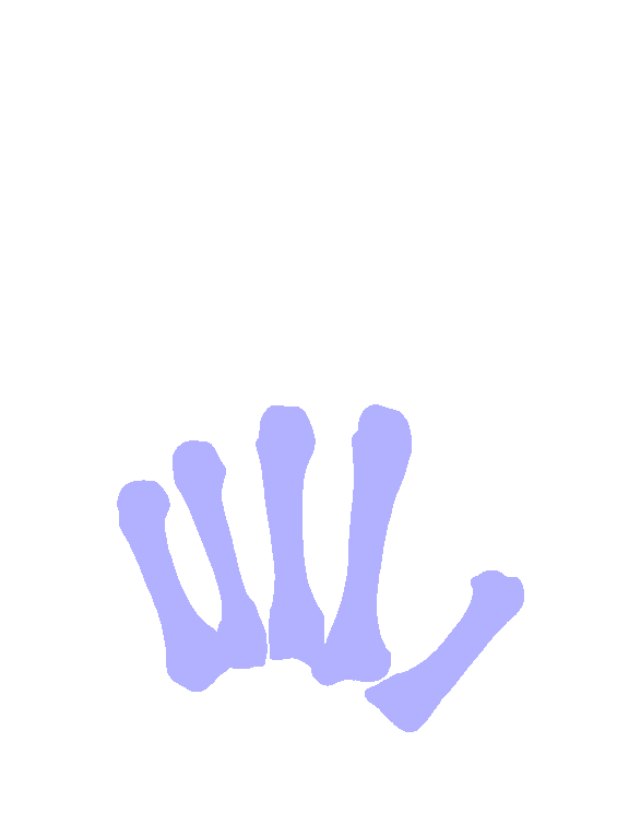 Metacarpals