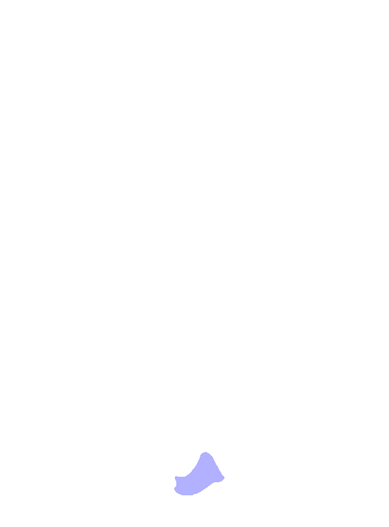 Scaphoid
