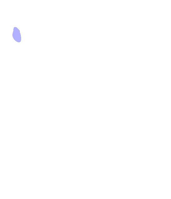 Anterior Superior Iliac Spine