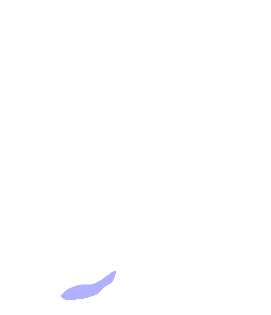 Ischial Tuberosity