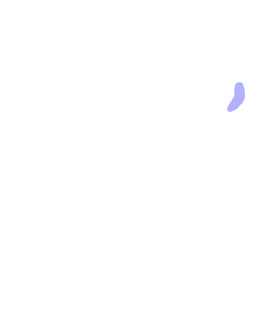Anterior Superior Iliac Spine