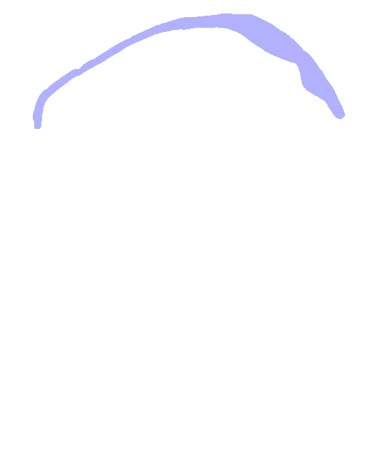 Iliac Crest