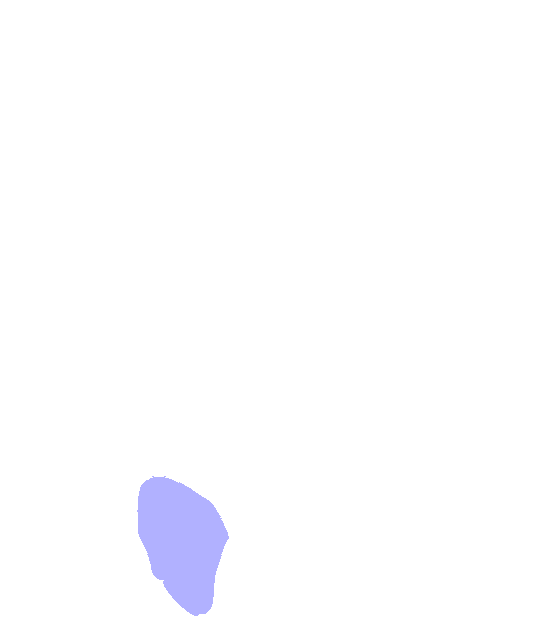 Ischial Tuberosity