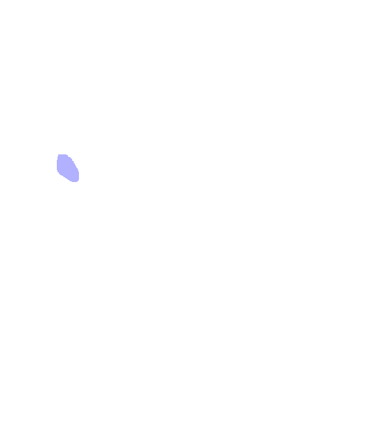 Posterior Inferior Iliac Spine