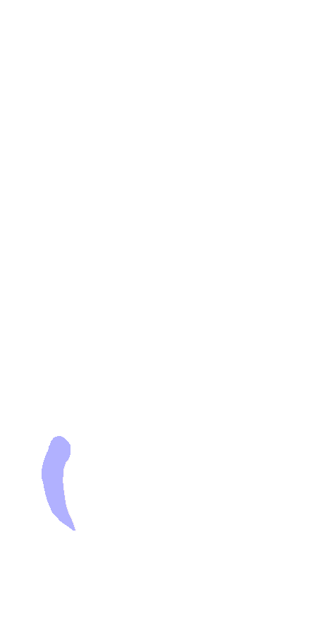 Lateral Epicondyle