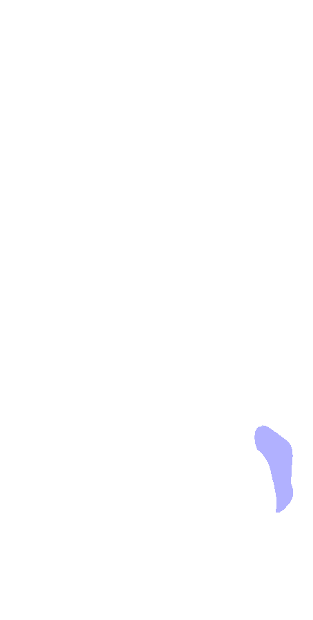 Medial Epicondyle
