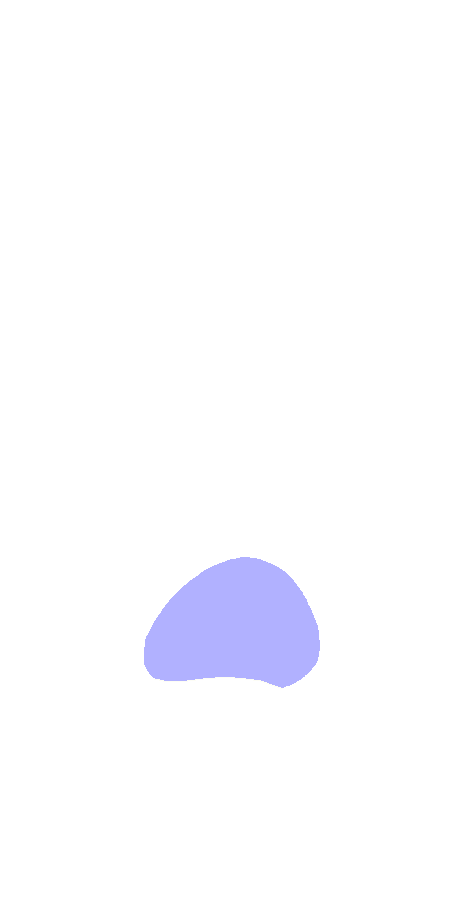 Olecranon Fossa