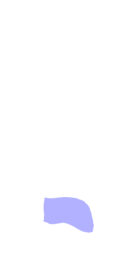 Trochlea