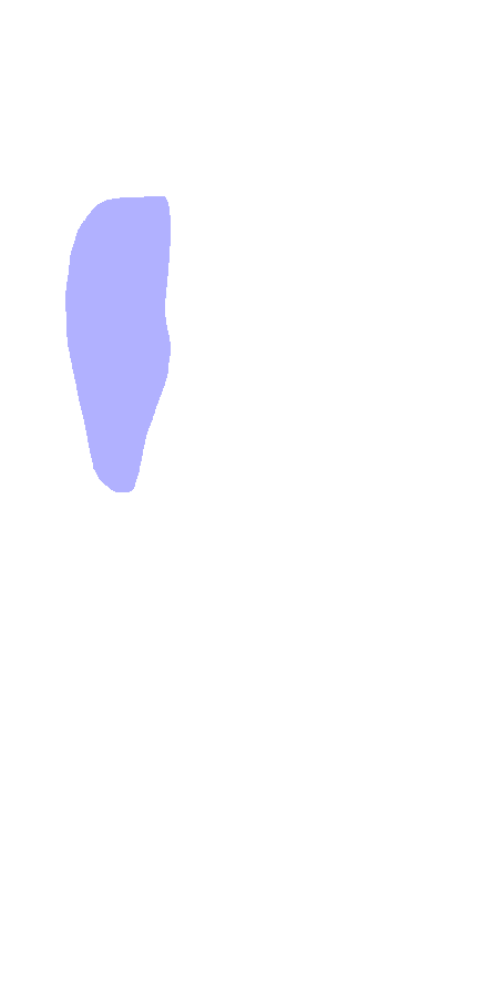 Greater Tubercle