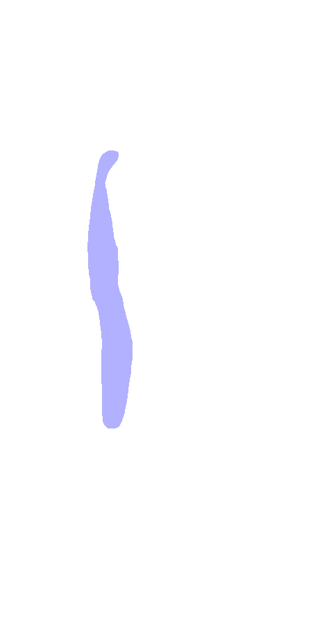 Intertubercular Sulcus