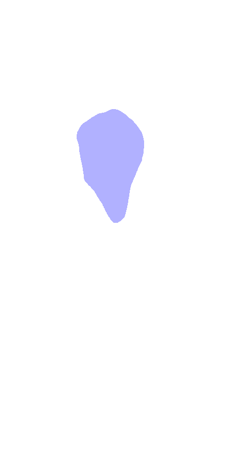 Lesser Tubercle