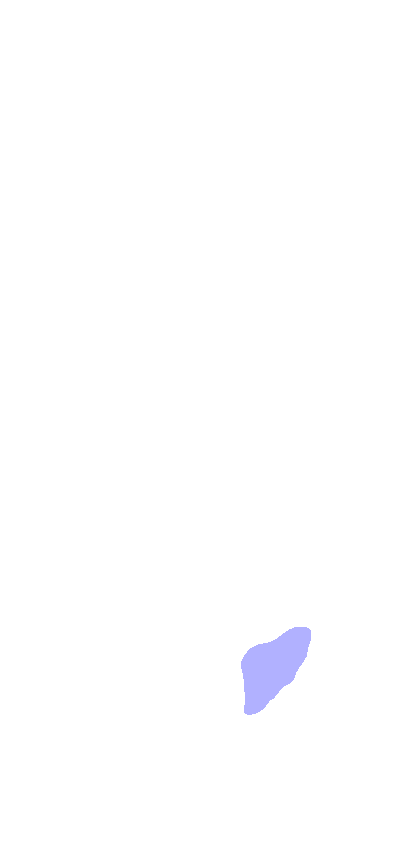 Styloid Process