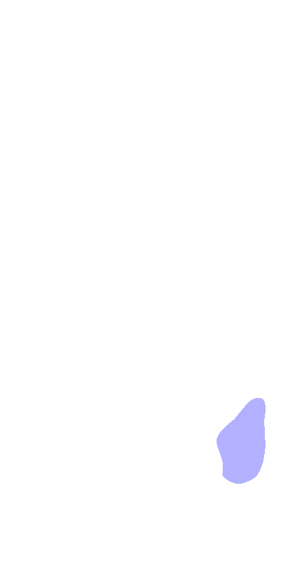 Styloid Process