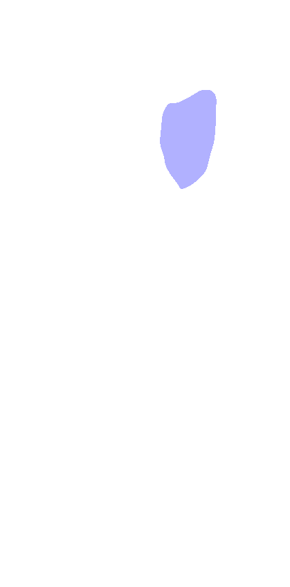 Radial Tuberosity