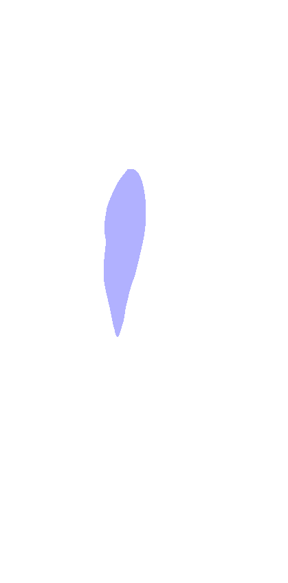 Radial Tuberosity