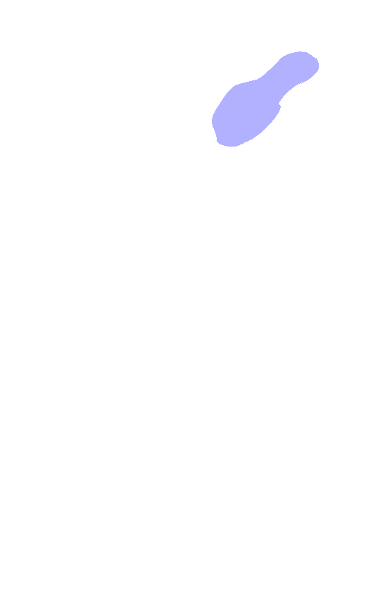 Coracoid Process