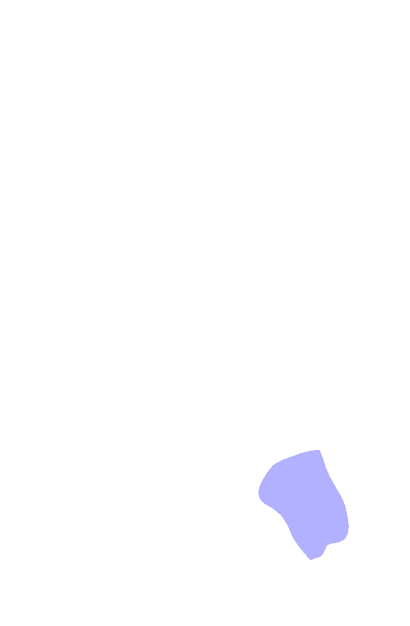 Medial Malleolus