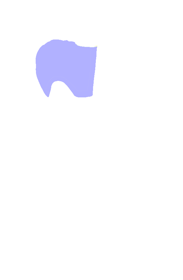 Lateral Condyle