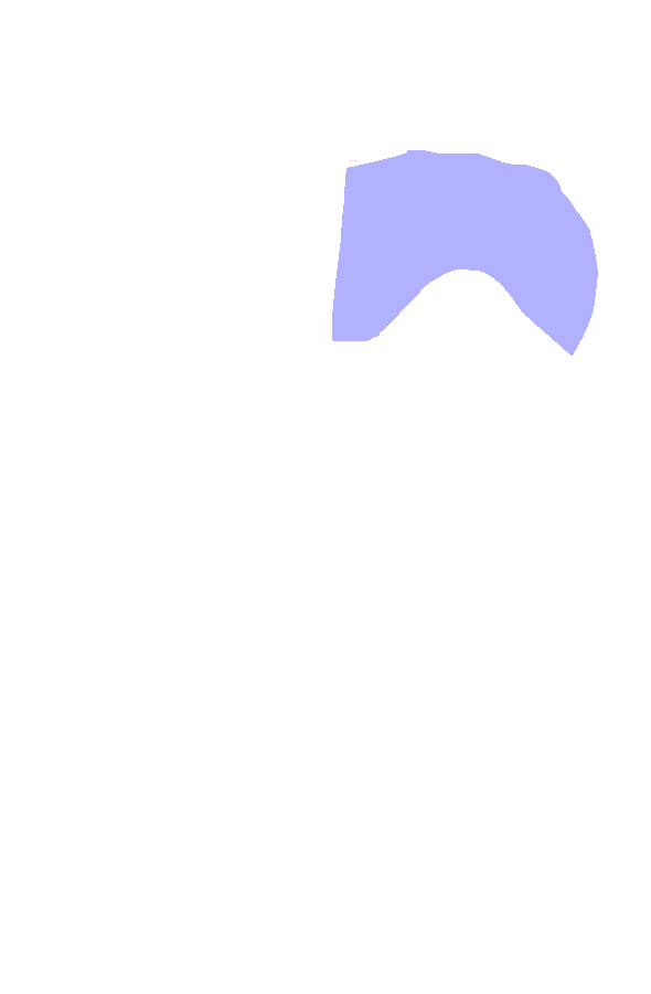 Medial Condyle