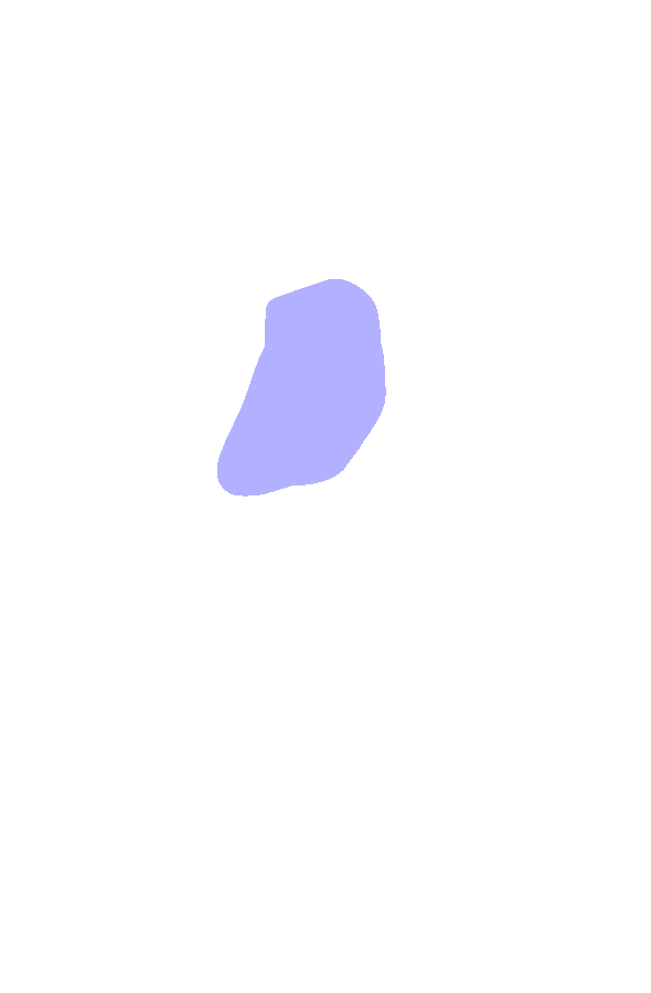 Tibial Tuberosity