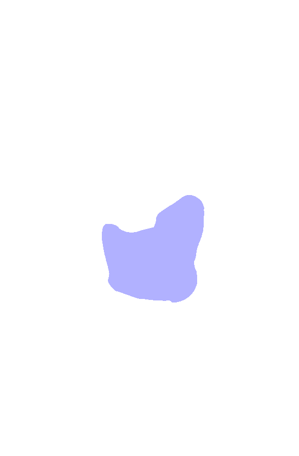 Intercondylar Eminence