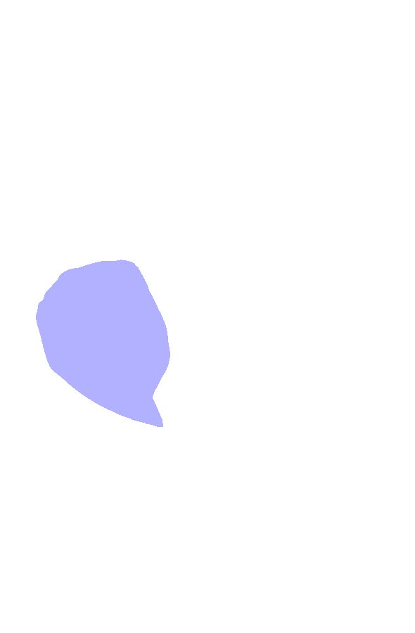 Lateral Condyle