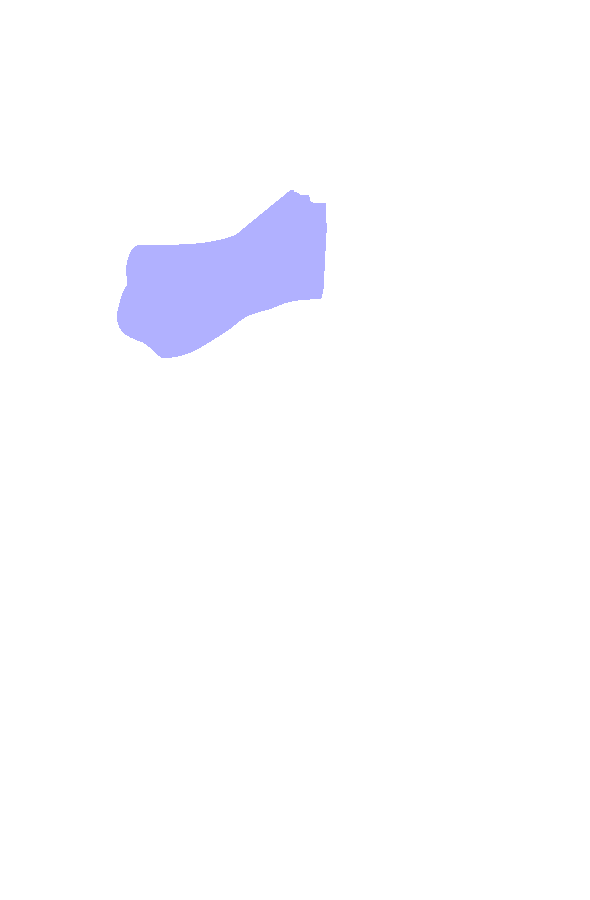 Lateral Condyle