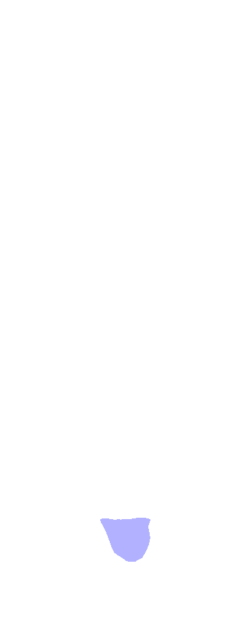 Styloid Process