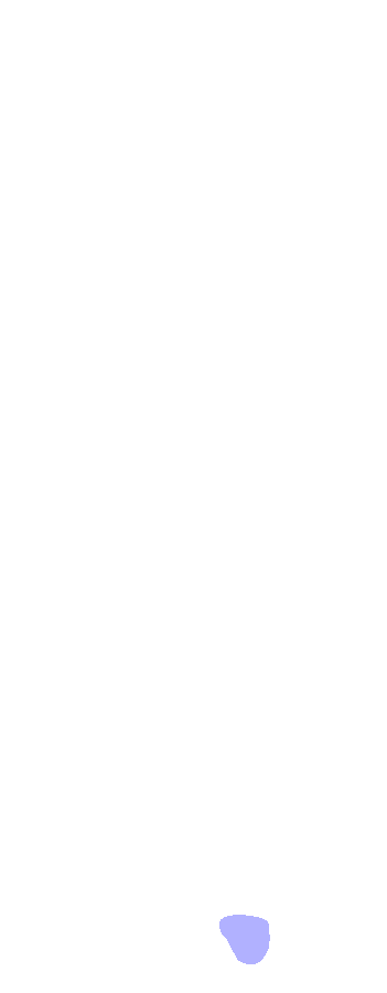 Styloid Process
