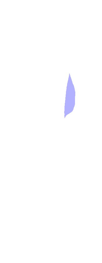 Coronoid Proces