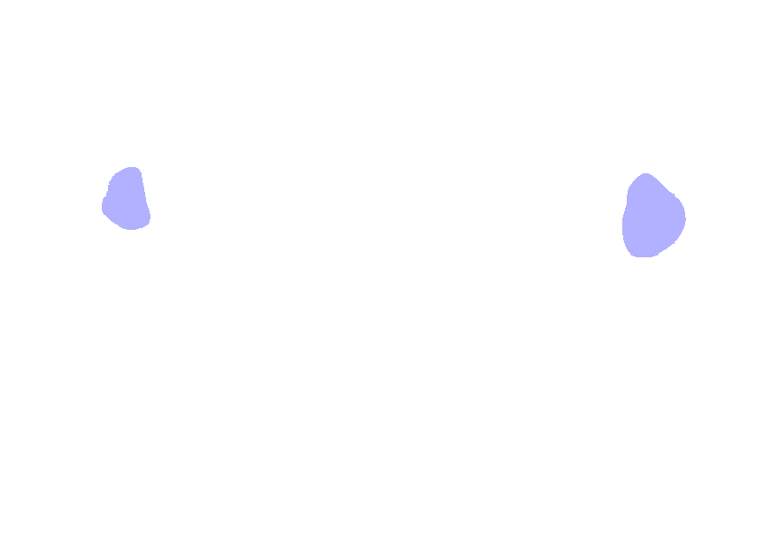 Transverse Foramen