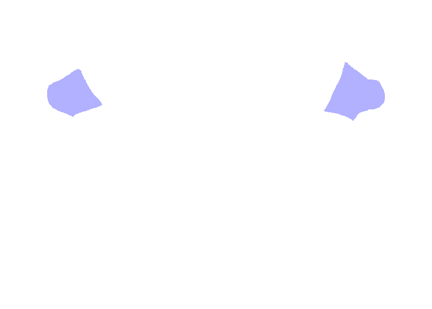 Transverse Process