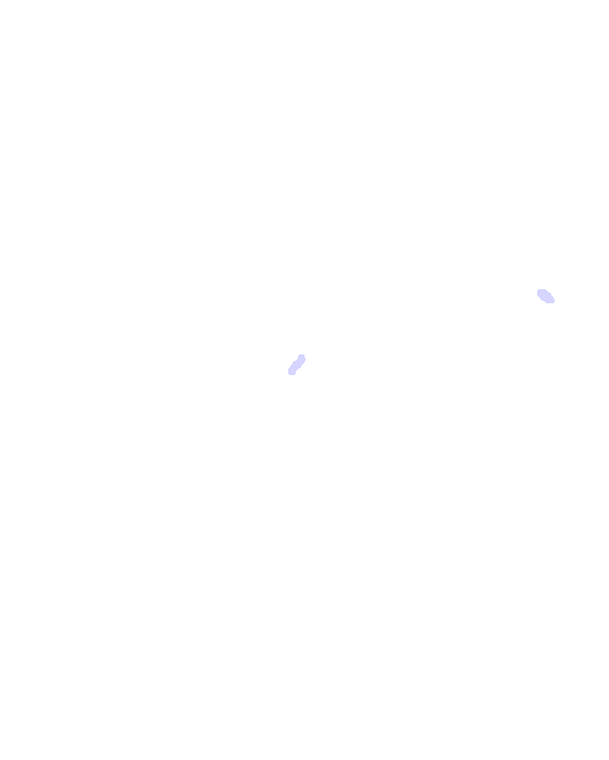 Infraorbital Foramen