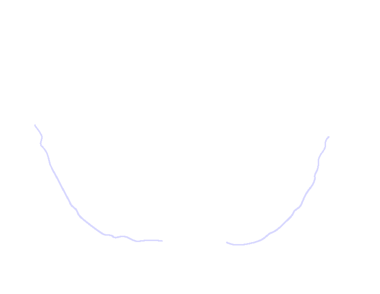 Superior Nuchal Lines