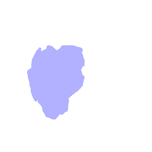 Sphenoid