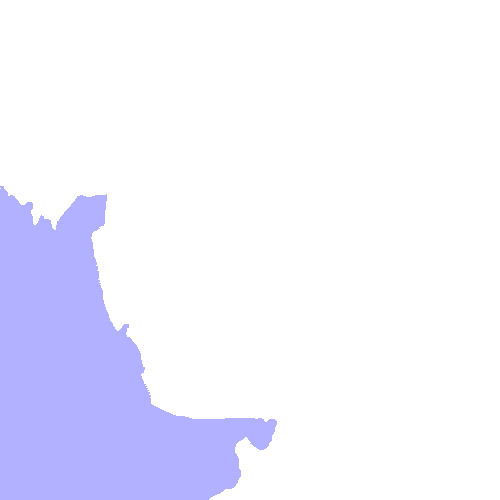 Zygomatic Bone
